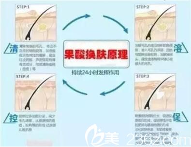 果酸換膚原理為什么會(huì)疼