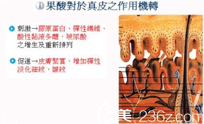果酸換膚作用