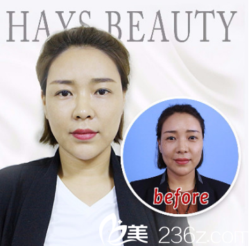 濟(jì)南海峽美容整形醫(yī)院線雕案例分享