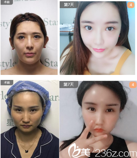 <!--<i data=20240703-sp></i>-->醫(yī)療美容診所線雕案例分享