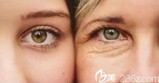 眼皮松弛下垂怎么辦