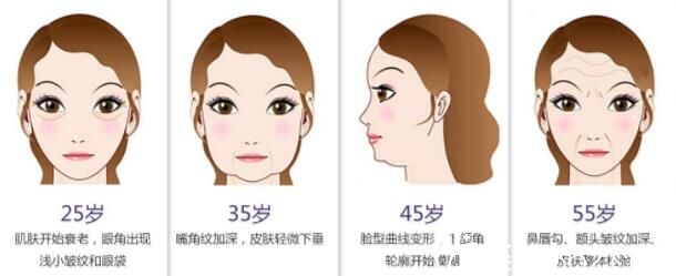 玻尿酸除皺范圍