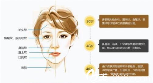 玻尿酸除皺方法