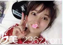 在北京聯(lián)合麗格做弦性面部提升第7天效果