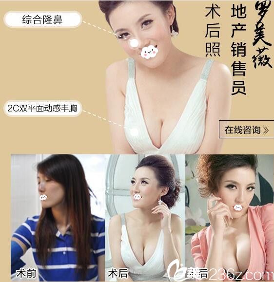淮北微悅醫(yī)療美容門診部假體鼻綜合、隆胸效果怎么樣