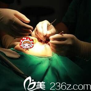 內(nèi)切祛眼袋手術(shù)過程中