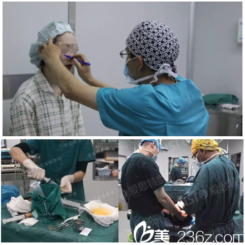 自體脂肪填充手術(shù)中