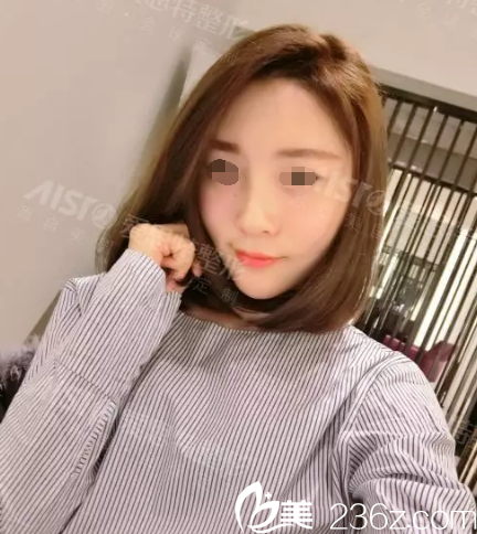 五天后自體脂肪填充恢復