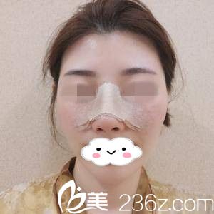 手術(shù)后第3天 手術(shù)后第3天