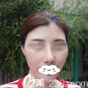 術(shù)后一周 術(shù)后一周