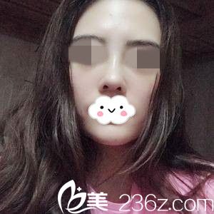 術后一周 術后一周