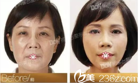 重慶銅雀臺(tái)線雕效果怎么樣 重慶銅雀臺(tái)線雕效果怎么樣