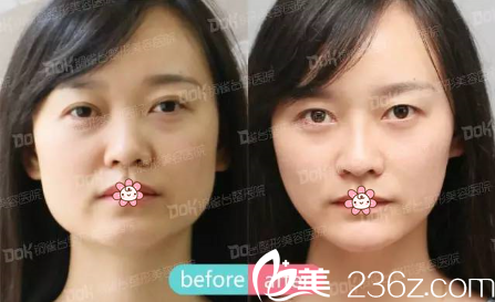 重慶銅雀臺(tái)線雕提拉案例 重慶銅雀臺(tái)線雕提拉案例