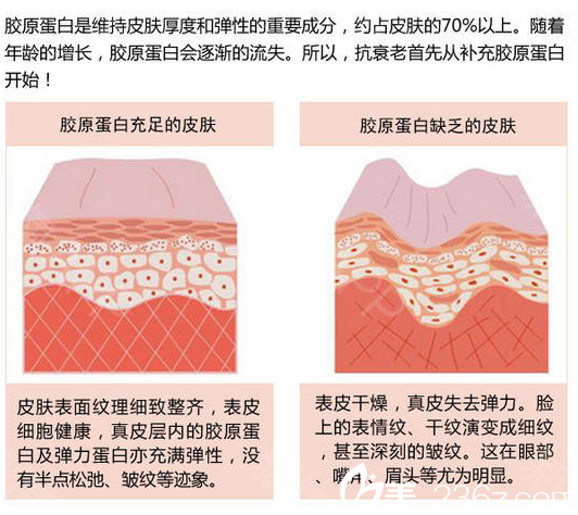 人體膠原蛋白皮膚情況對比