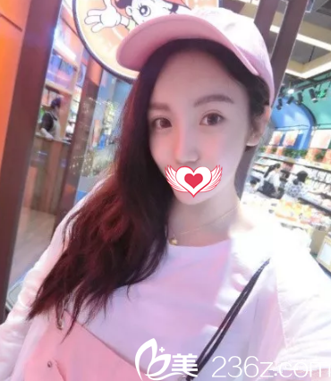 術前胸部平坦 術前胸部平坦