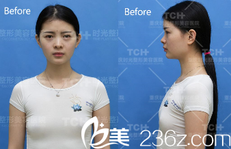 去重慶時光面診的小嬰 去重慶時光面診的小嬰