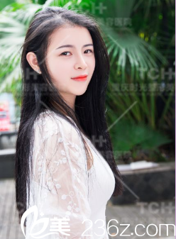 重慶時光假體隆胸效果自然 重慶時光假體隆胸效果自然