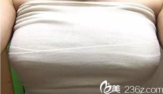 來福琳隆胸手術(shù)第3天