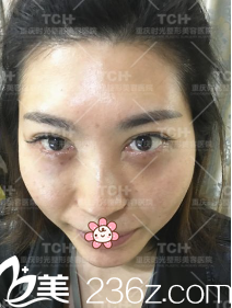 手術(shù)后天的森女士 手術(shù)后天的森女士