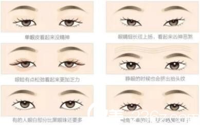 開眼角手術方法