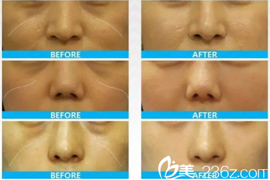 印第安紋 印第安紋