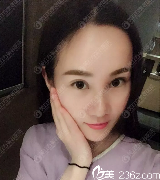 幫忙看看我找東莞美立方鄭志敏做的鼻綜合隆鼻案例效果怎么樣