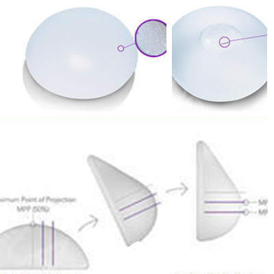 趙镕賢院長假體隆胸分類 趙镕賢院長假體隆胸分類