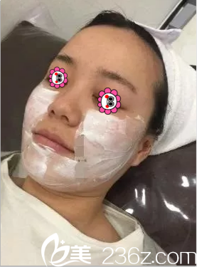 在北京華韓做熱瑪吉美膚面部敷麻樣子 在北京華韓做熱瑪吉美膚面部敷麻樣子