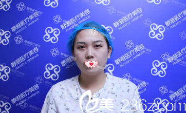 術(shù)前面部蒼老 術(shù)前面部蒼老