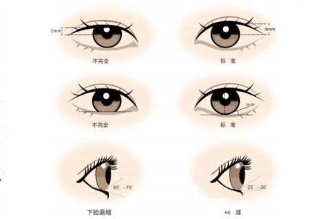 腫泡眼是怎么形成的