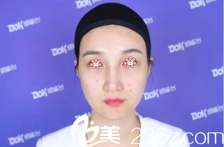 術(shù)前的小饒