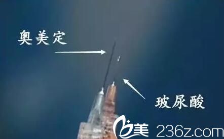 奧美定和玻尿酸感官和觸覺不同