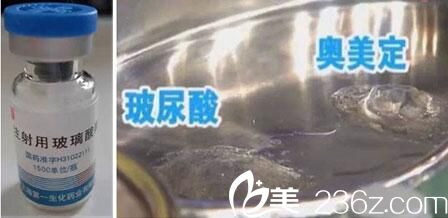 奧美定和玻尿酸感官和觸覺不同奧美定和玻尿酸溶解酶不同
