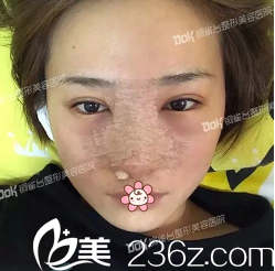 <!--<i data=20240703-sp></i>-->院長(zhǎng)給子墨手術(shù)后第三天