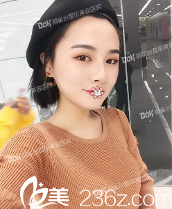 <!--<i data=20240703-sp></i>-->鼻綜合術(shù)后一個(gè)月