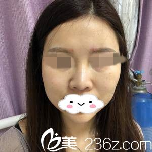 手術(shù)前的我 手術(shù)前的我