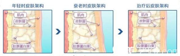 熱瑪吉多少錢？