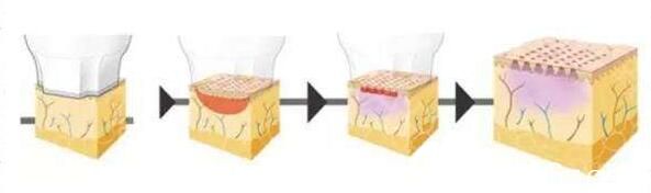 熱瑪吉價(jià)格與什么有關(guān)？