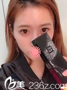 韓國(guó)整形醫(yī)生申?yáng)捄膊恢寡劬C合做的好，面部脂肪填充+鼻綜合讓我變身靚麗辣媽