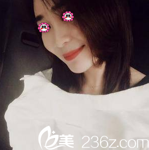 我在北京亞韓做V塑加面部脂肪填充第48天效果 我在北京亞韓做V塑加面部脂肪填充第48天效果