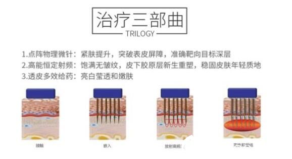 黃金點(diǎn)陣射頻原理