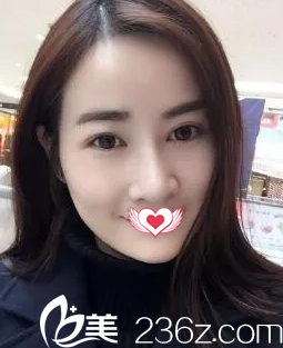 術(shù)后7天拆線鼻子微腫 術(shù)后7天拆線鼻子微腫