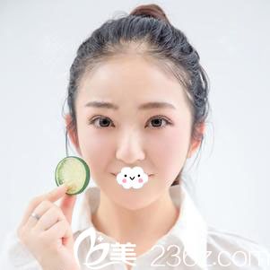 阜陽東方美萊塢雙眼皮失敗修復(fù)術(shù)后2個月