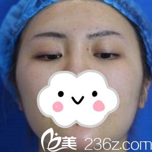 手術前的我 手術前的我