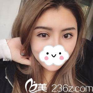 手術后第22天 手術后第22天