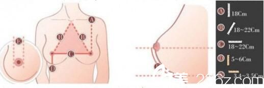 自體脂肪隆胸優(yōu)勢