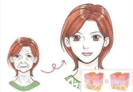 可以長(zhǎng)期打玻尿酸嗎？