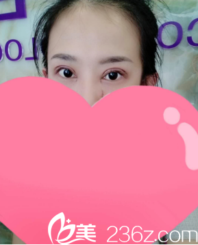 剛做完的時(shí)候真的是腫成狗了