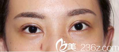 恢復(fù)的特別快