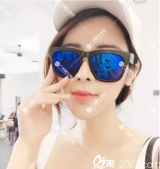 廣州曙光耳軟骨隆鼻和鼻翼縮小術(shù)后兩個(gè)月案例圖 廣州曙光耳軟骨隆鼻和鼻翼縮小術(shù)后兩個(gè)月案例圖